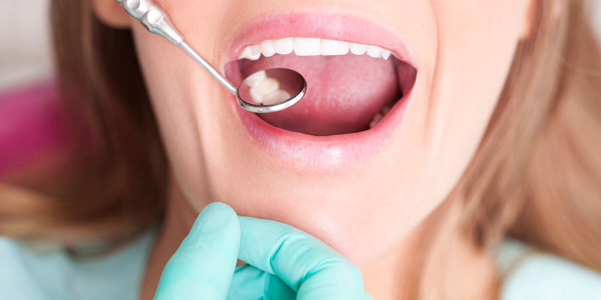 Closeup of Teeth with Dental Mirror
