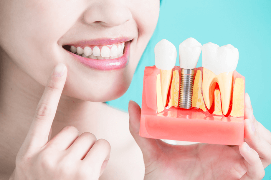 What is the Cost of Dental Implants in Murray Hill NYC?